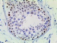 BCOR (BSB-128), MMab MAIN