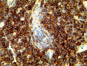 PD-L1 / CD274 (28-8), RMab MAIN