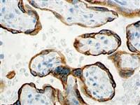 PLAP (EP194), RMab MAIN