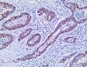 PMS2 (RBT-PMS2), RMab MAIN