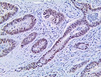 PMS2 (RBT-PMS2), RMab MAIN