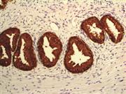 Prostate-Specific Antigen (PSA) (BSB-7), MMab THUMBNAIL