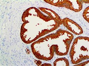 Prostate-Specific Antigen (PSA) (RBT-PSA), RMab MAIN