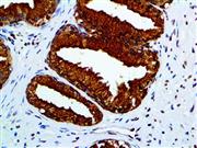 PSAP (PASE/4LJ), MMab THUMBNAIL