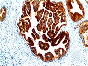 PSMA (EP192), RMab THUMBNAIL