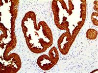 PSP94 / MSMB (EP203), RMab MAIN