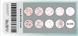 9-Core PTEN Cell Line Microarray MAIN