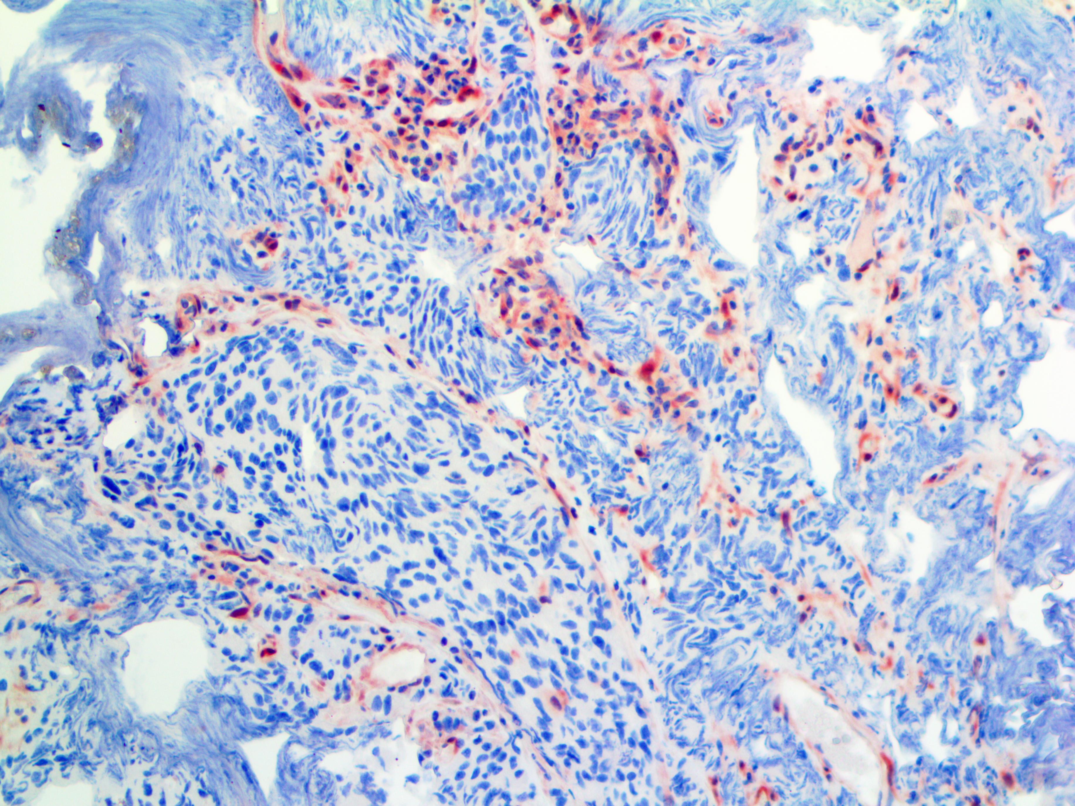 PTEN (RM265), RMab MAIN