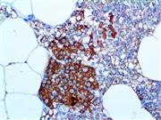 Parathyroid Hormone / PTH (BSB-24), MMab THUMBNAIL