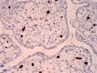 Parvovirus (R92F6), MMab MAIN