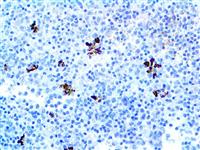 Perforin (5B10), MMab MAIN