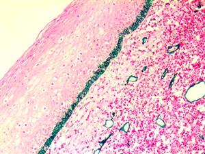 Podoplanin / D2-40 (D2-40), MMab MAIN