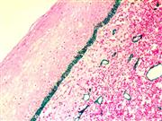 Podoplanin / D2-40 (D2-40), MMab THUMBNAIL