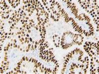 Progesterone Receptor (RBT-22), RMab MAIN