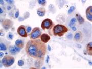 Prolactin (EP193), RMab THUMBNAIL