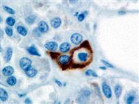 Prolactin (PRL02), MMab MAIN