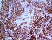 ROS-1 (EP282), RMab MAIN