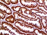 Retinoblastoma (1F8), MMab MAIN