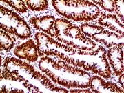 Retinoblastoma (1F8), MMab THUMBNAIL