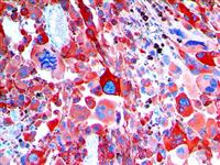 S100 Beta (EP32), RMab MAIN