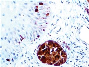 S100A1 (EP184), RMab MAIN