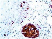 S100A1 (EP184), RMab MAIN