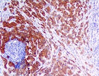 S100P (RBT-S100P), RMab MAIN