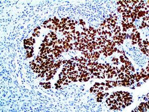 SALL4 (6E3), MMab MAIN