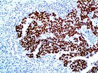 SALL4 (6E3), MMab MAIN