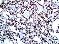 SALL4 (EP299), RMab MAIN