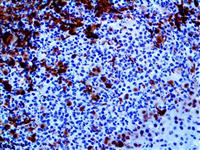 SMAD4 / DPC4 (BSB-63), MMab MAIN