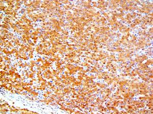 SMAD4 / DPC4 (RBT-SMAD4), RMab MAIN
