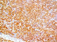 SMAD4 / DPC4 (RBT-SMAD4), RMab MAIN