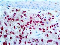 SOX-10 (EP268), RMab MAIN