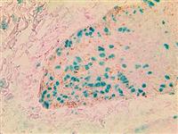 TintoFast SOX-10 (BSB-62), MMab MAIN