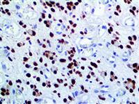 SOX-2 (RM427), RMab MAIN