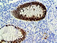 SOX-9 (EP317), RMab MAIN