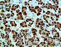 STAR (EP226), RMab MAIN