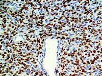 STAT6 (EP325), RMab MAIN