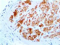 Smoothelin (R4A), MMab MAIN