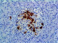 Somatostatin (EP130), RMab MAIN