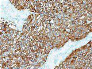 Synaptophysin (Polyclonal), RPab MAIN