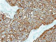 Synaptophysin (Polyclonal), RPab THUMBNAIL
