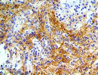 Alpha Synuclein (BSB-114), MMab MAIN