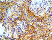 Alpha Synuclein (BSB-114), MMab THUMBNAIL
