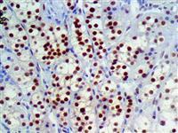 TFE3 (EP285), RMab MAIN