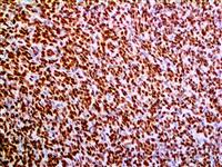 tle1 tle-1 tle 1, TLE1, anti-TLE1, anti TLE1, Enhancer of split groucho-like protein 1 (ESG1), anti-Enhancer of split gr MAIN