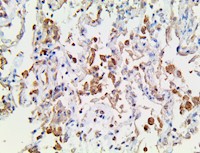 tnfaip2, tnfa, tnfaip, tnfa-ip2, anti-tnfa-ip2, anti-tnfaip2 anti-tnfa, anti-tnfaip, Tumor Necrosis Factor alpha Induced MAIN