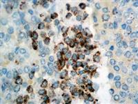 TRAcP (9C5), MMab MAIN