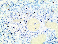 panTRK (TRK), RMab MAIN